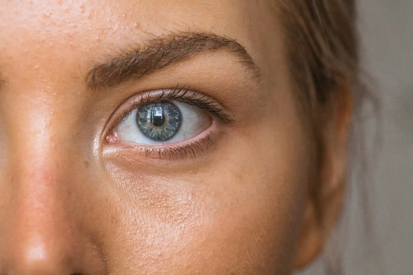 Non-Surgical Eyelid Tightening with AgeJet